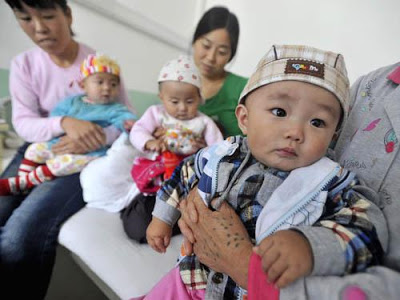 Bebes com cálculos renais, leite em pó adulterado